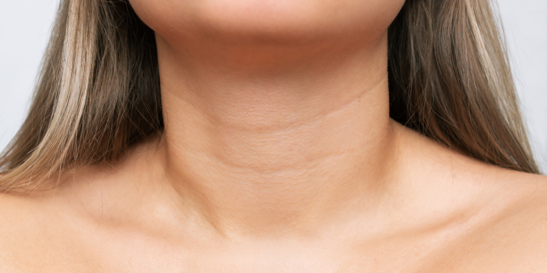 How to Reduce Neck Lines: Best Skincare and Clinic Treatments