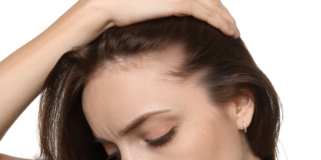 Hair Loss: What Your Hair May Be Telling You
