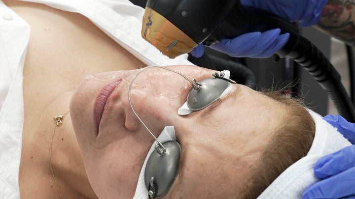 BTS Titanium Lifting