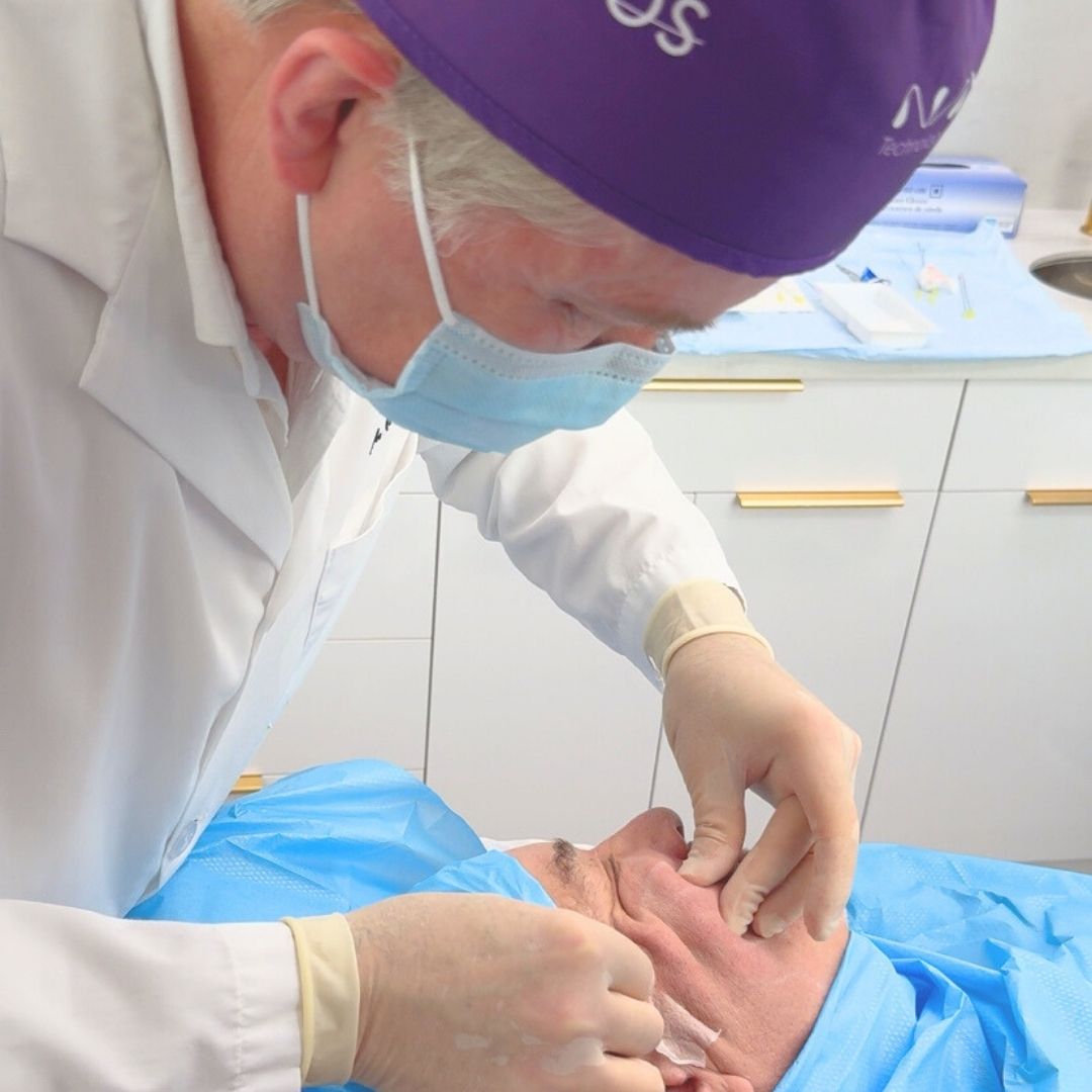 Thread Lift | Non-Surgical Facial Lifting & Contouring