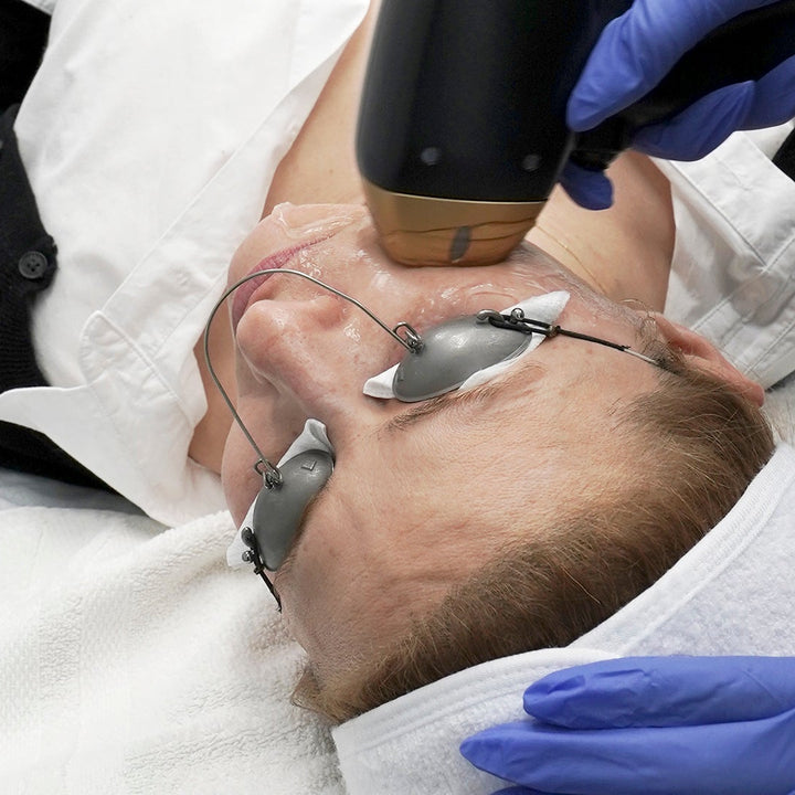 BTS Titanium Lifting