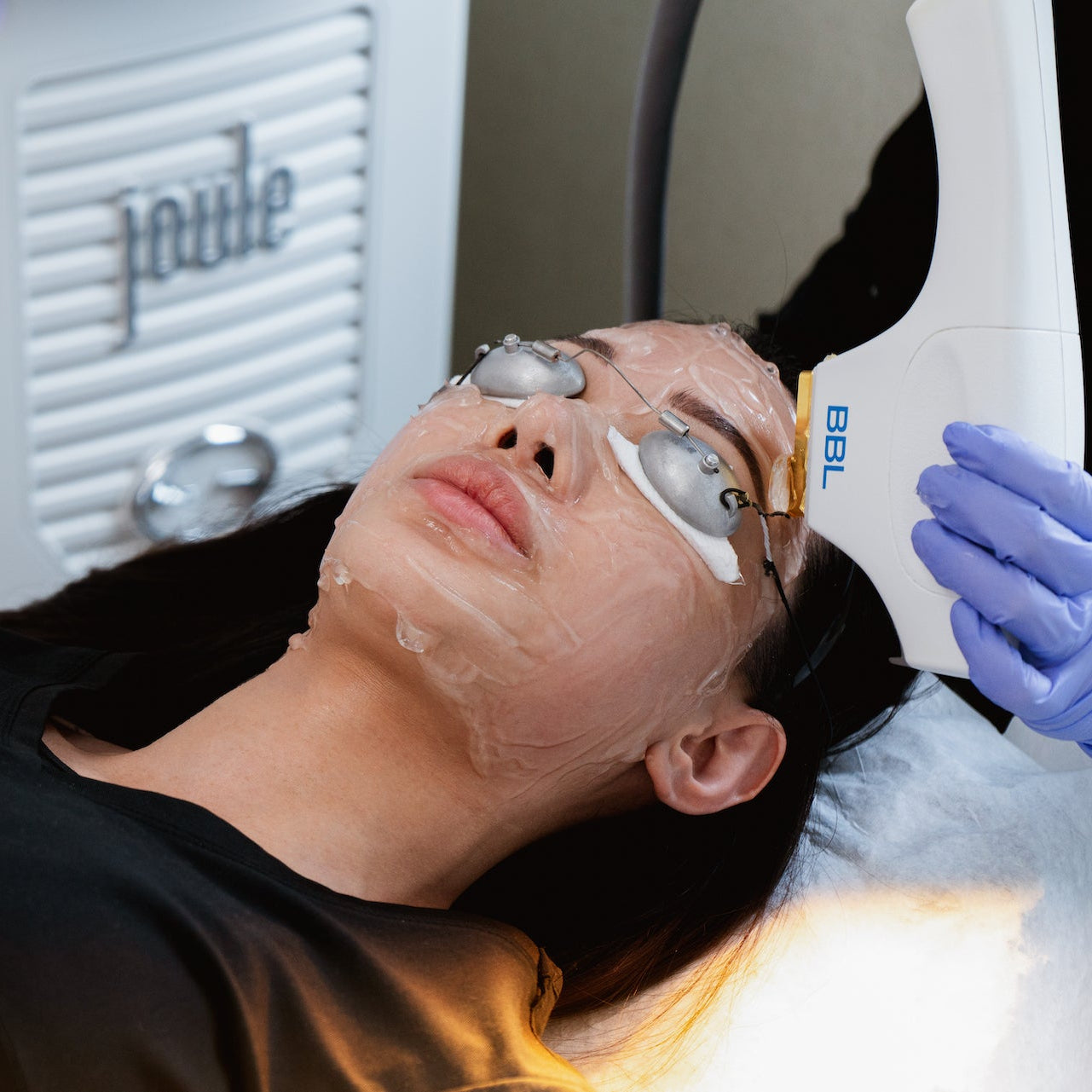 A person receiving a BBL Broadband Light treatment on their face, with a focus on skin rejuvenation.