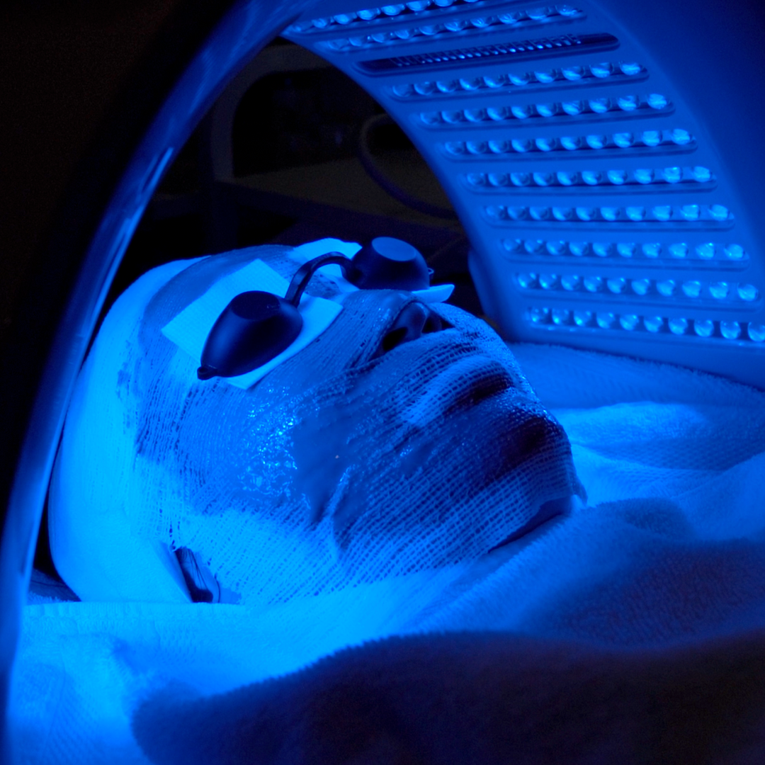 Cold Laser Therapy