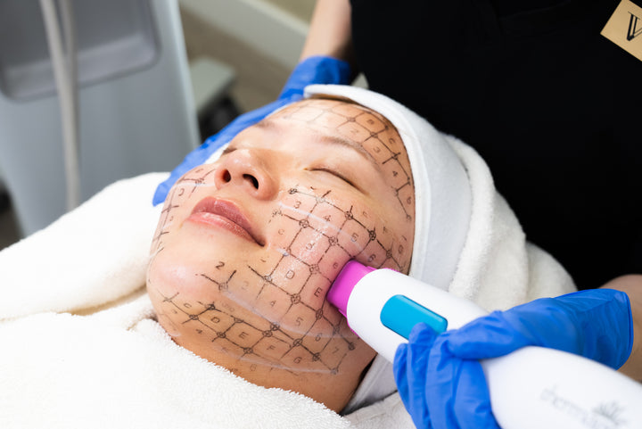 THERMAGE®FLX 热玛吉 (凤凰电波)