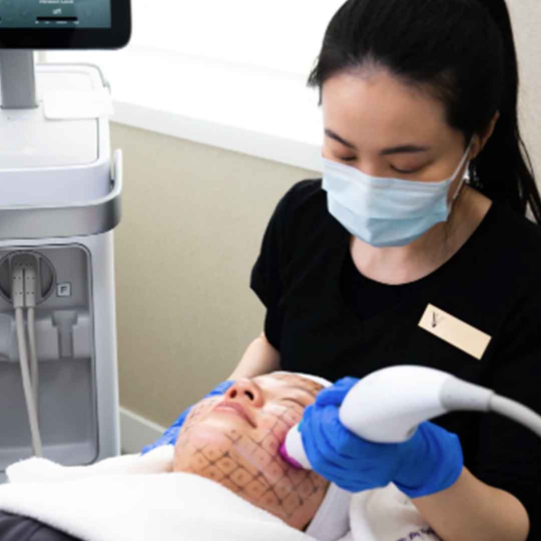 THERMAGE®FLX 热玛吉 (凤凰电波)