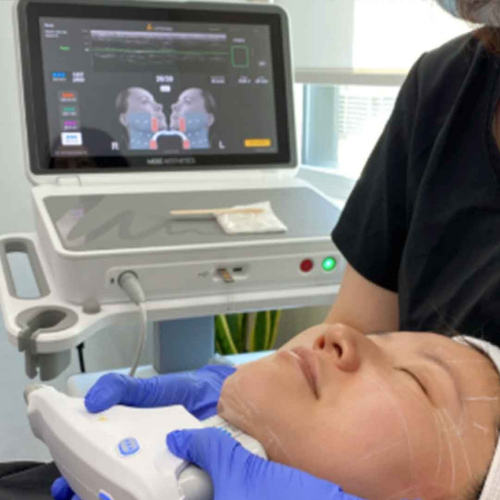 Ultherapy® Prime 新版超声刀