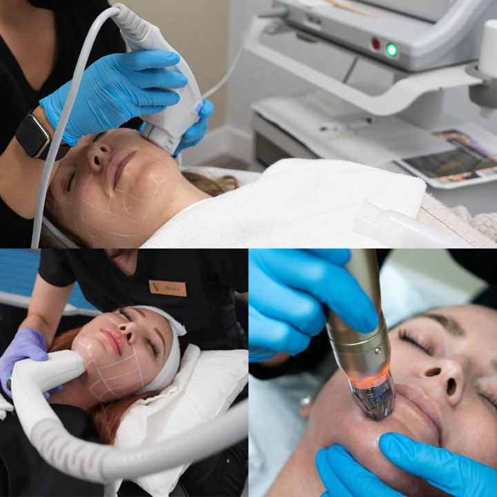 UltraLift Max | Sofwave + Sylfirm + Ultherapy