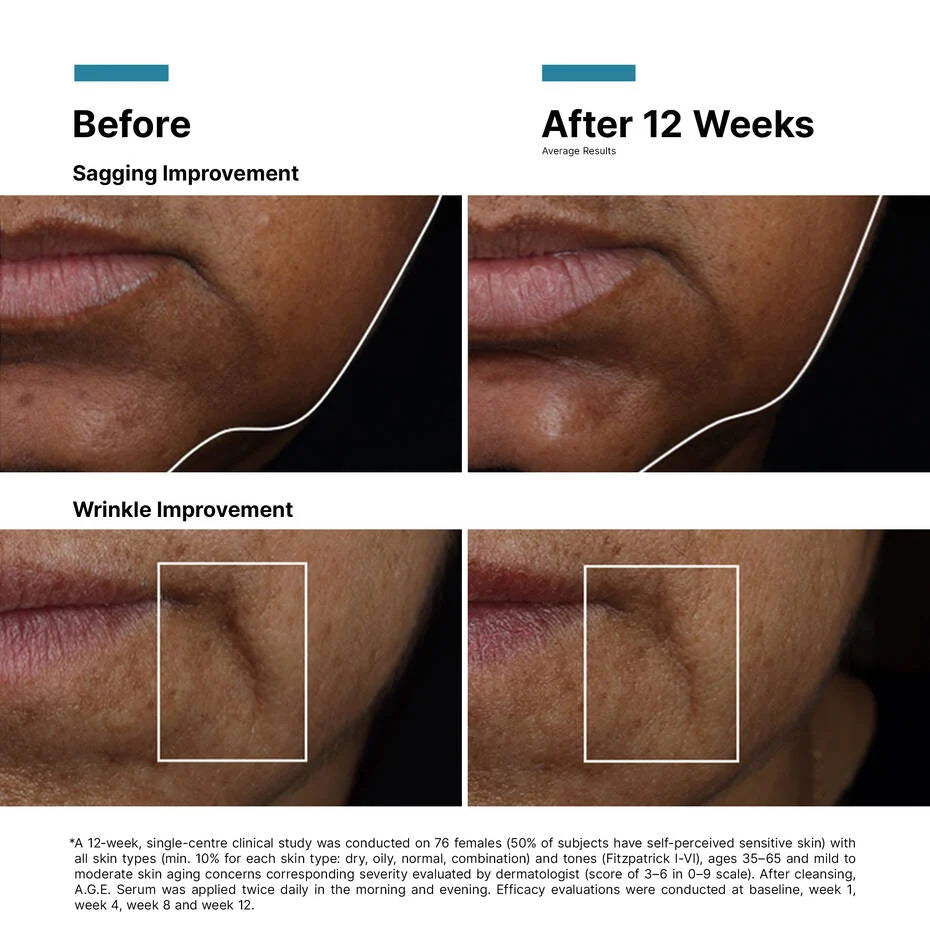 SkinCeuticals A.G.E Interrupter Ultra Serum 30ml