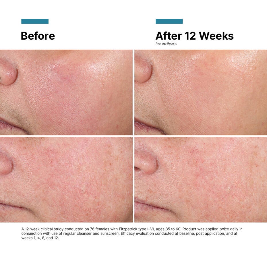 SkinCeuticals Advanced RGN-6