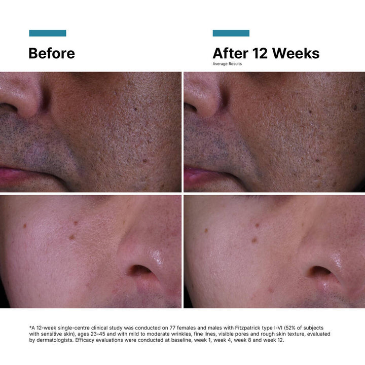 SkinCeuticals P-Tiox Anti-Wrinkle Cream