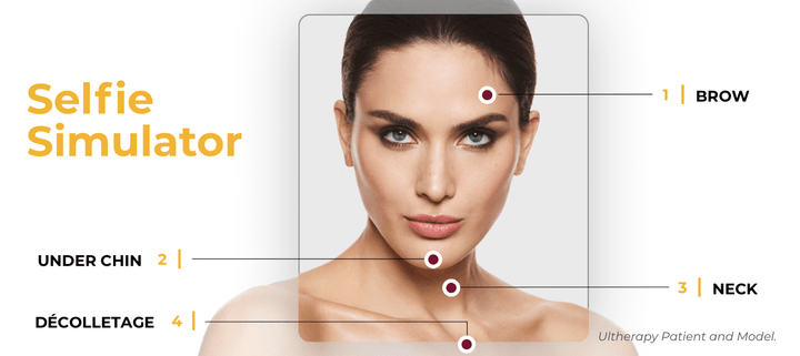 Ultherapy® Prime