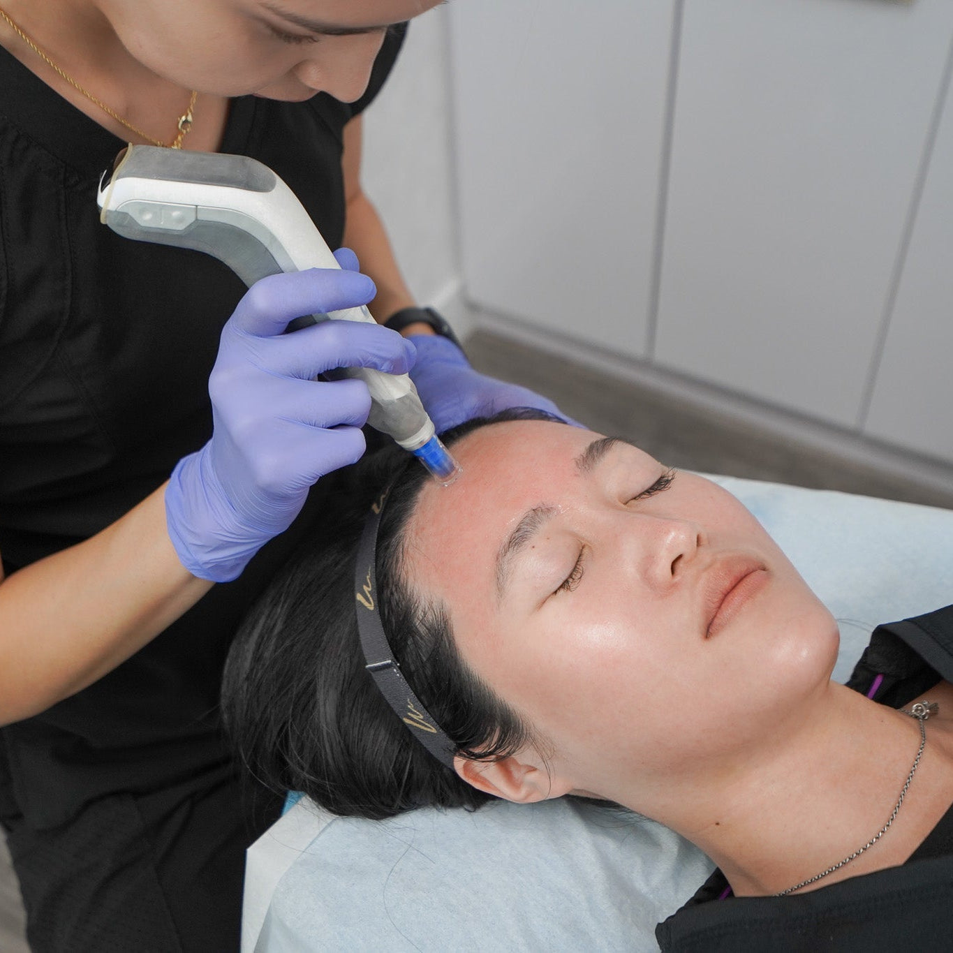 Microneedling