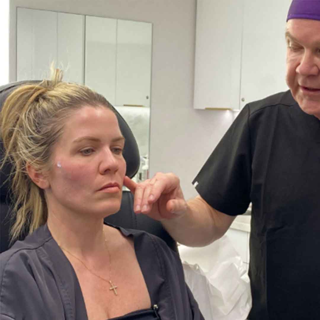 线雕提升 | 非手术面部轮廓提拉